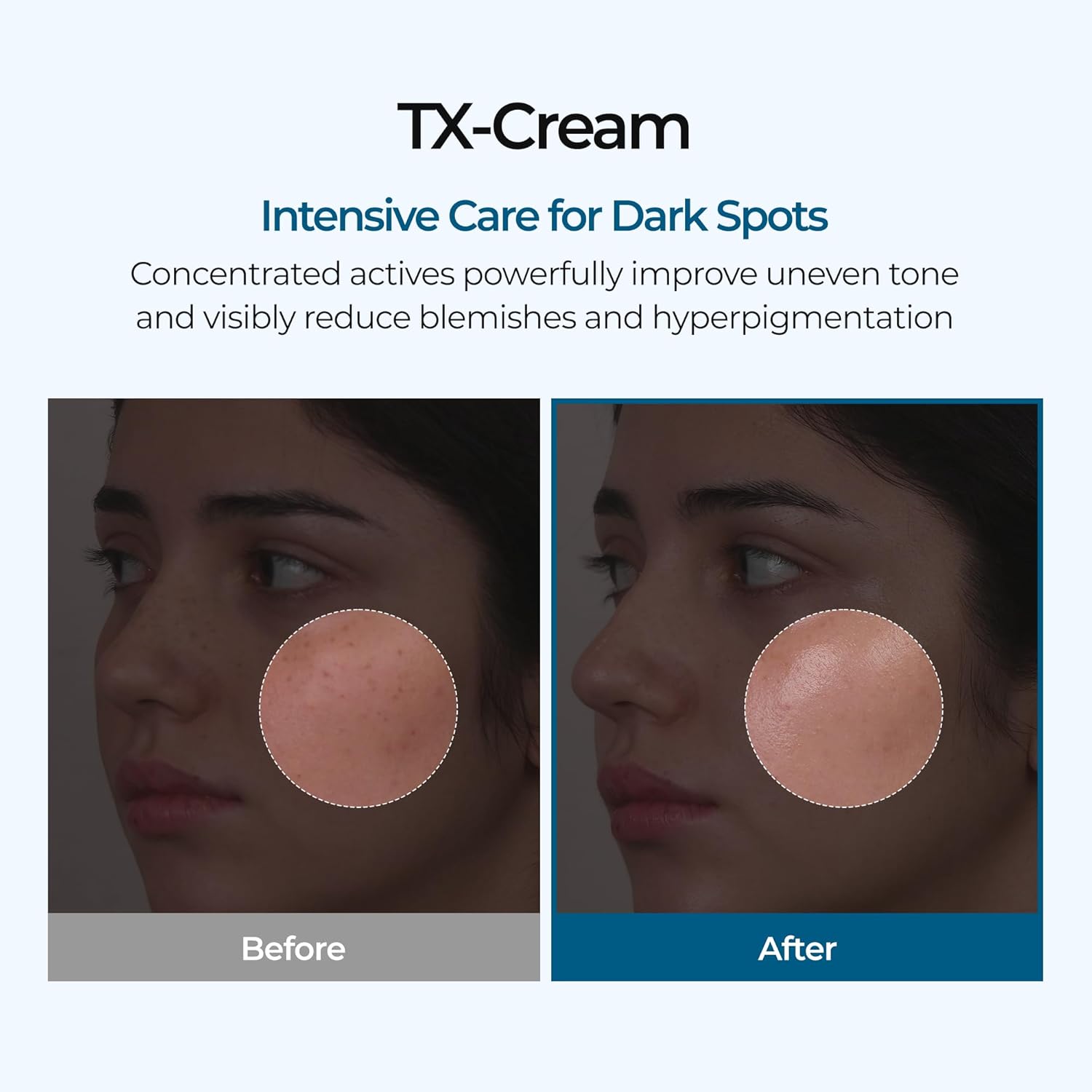 Dr.Melaxin TX Cream [50ml]